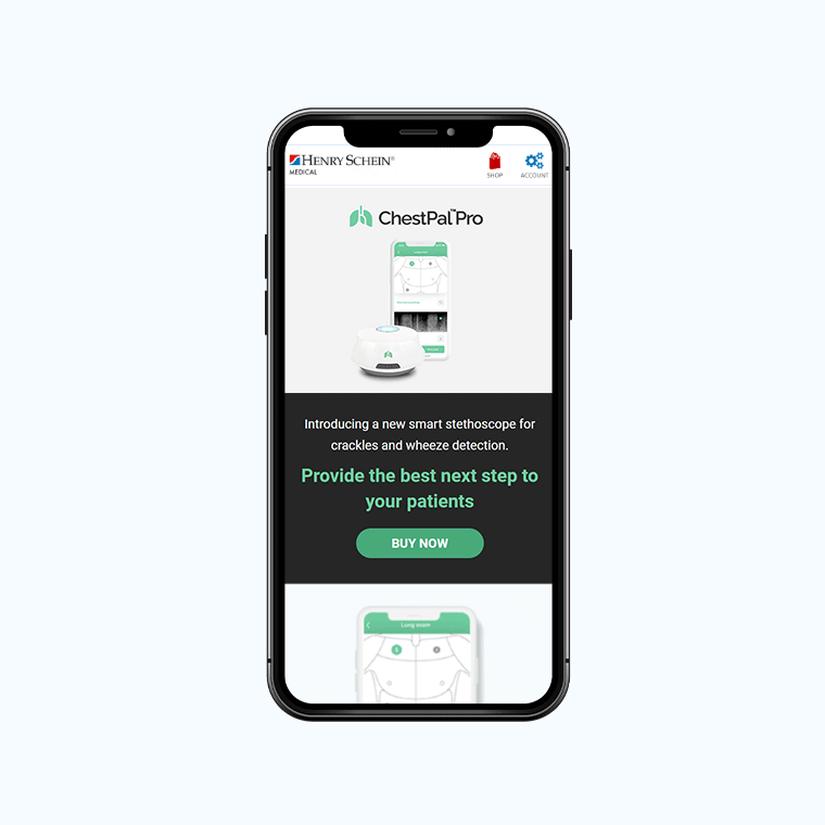 Chestpal mobile feature